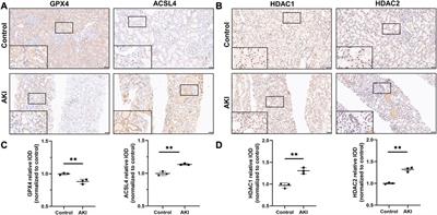 VPA improves ferroptosis in tubular epithelial cells after cisplatin-induced acute kidney injury